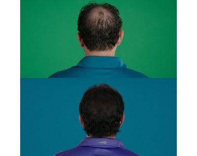 Velform Hair Grow 1+ 1 Grátis